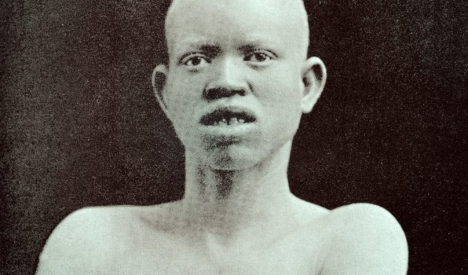 Se beben nuestra sangre